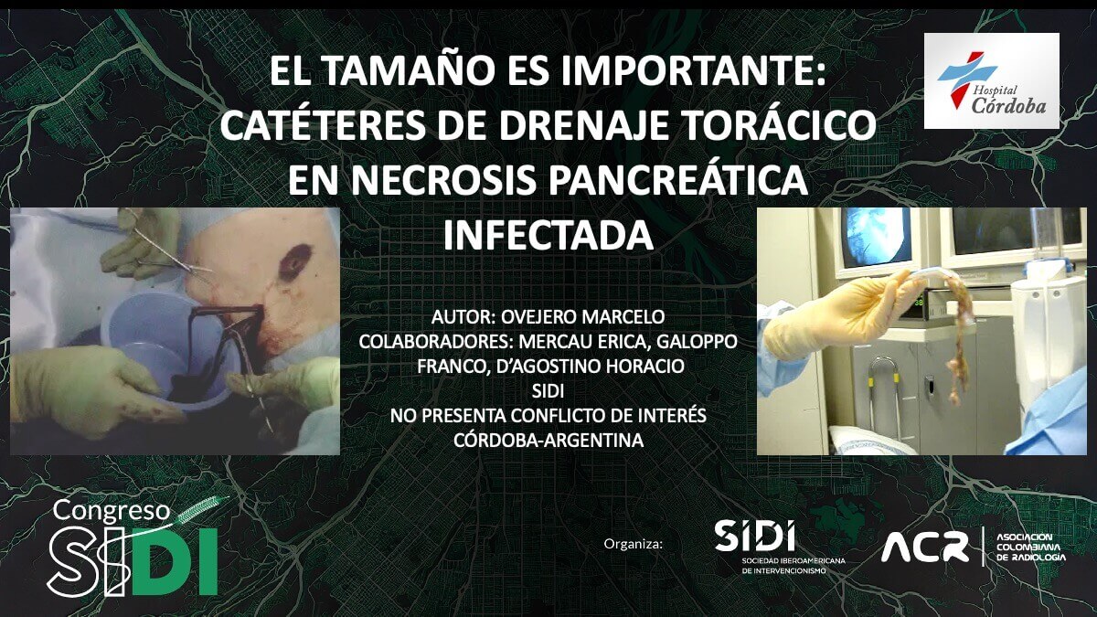 El tamaño es importante: catéteres de drenaje torácico en necrosis pancreática infectada
