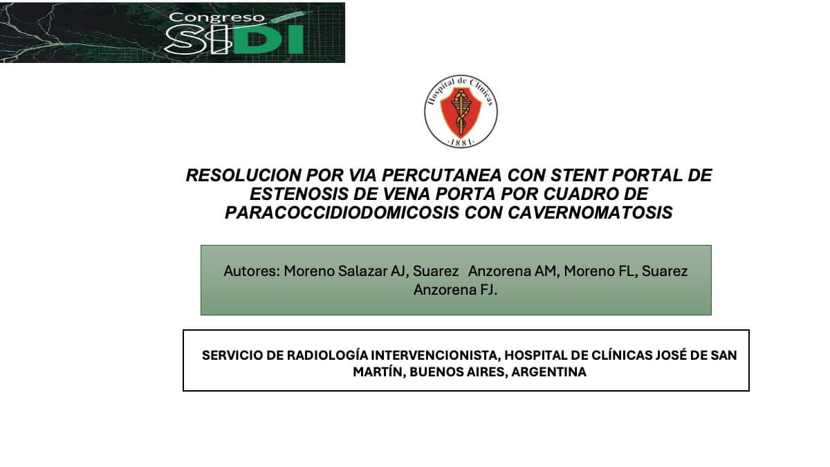 Resolución por vía percutánea con stent portal de estenosis de vena porta por cuadro de paracoccidiodomicosis con cavernomatosis