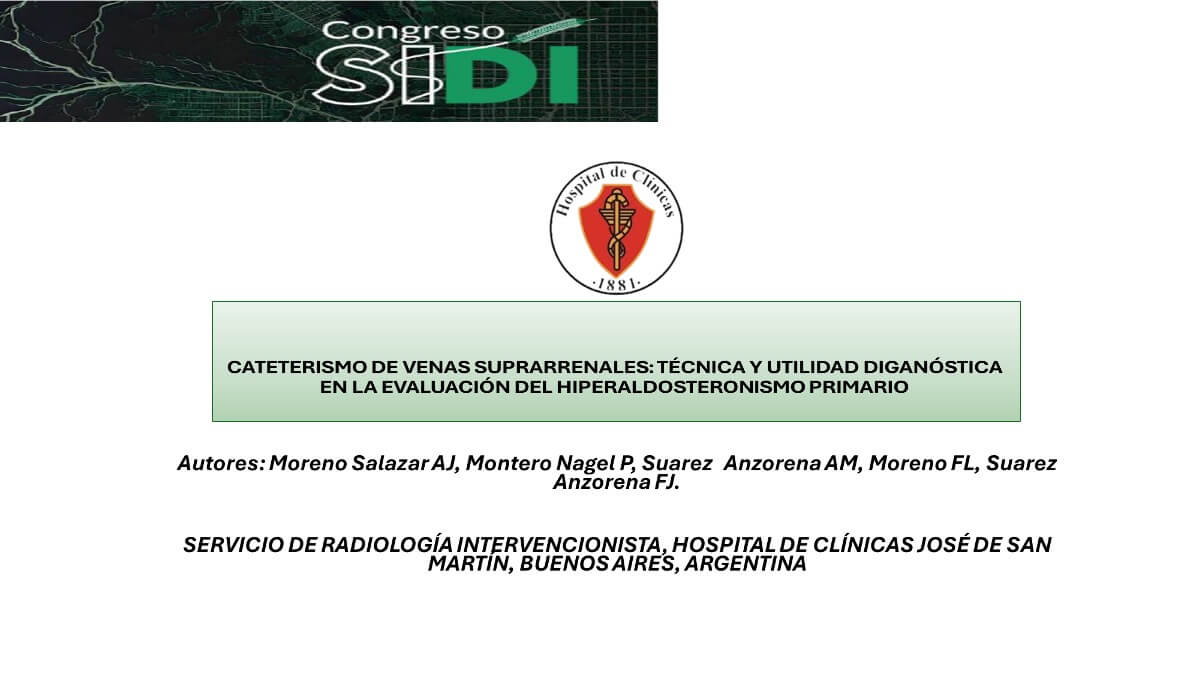 Cateterismo de venas suprarrenales: técnica y utilidad diagnóstica en la evaluación del hiperaldosteronismo primario
