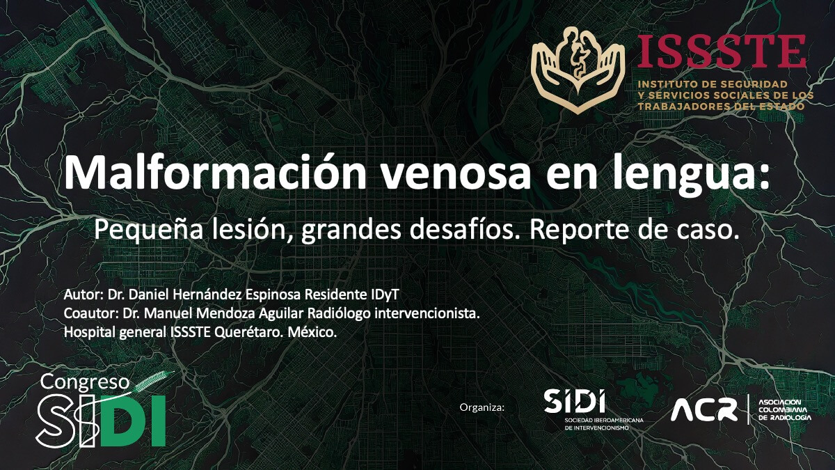 Malformación venosa en lengua: pequeña lesión, grandes desafíos. Reporte de un caso