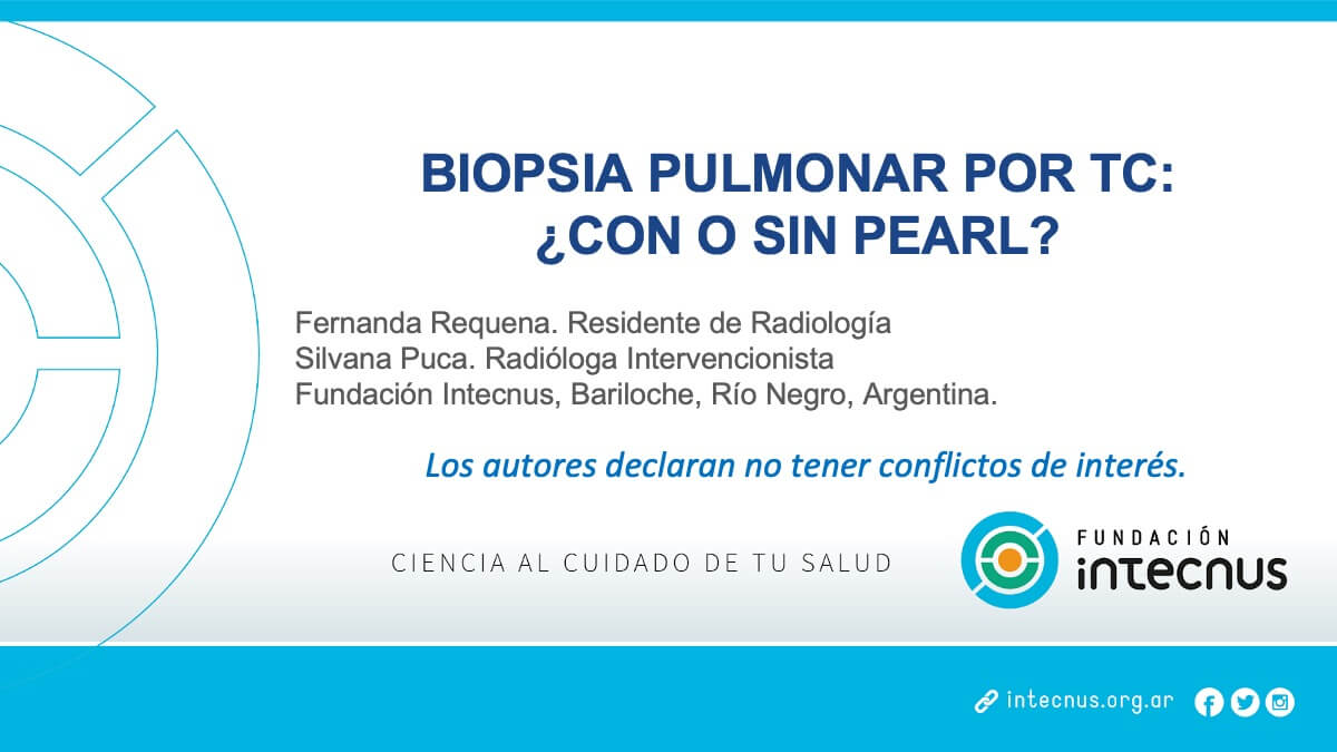 Biopsia pulmonar por TC: ¿con o sin Pearl?