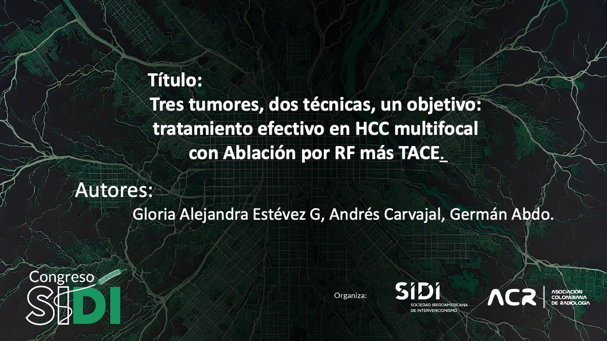 Tres tumores, dos técnicas, un objetivo: tratamiento efectivo en HCC multifocal con Ablación por RF más TACE