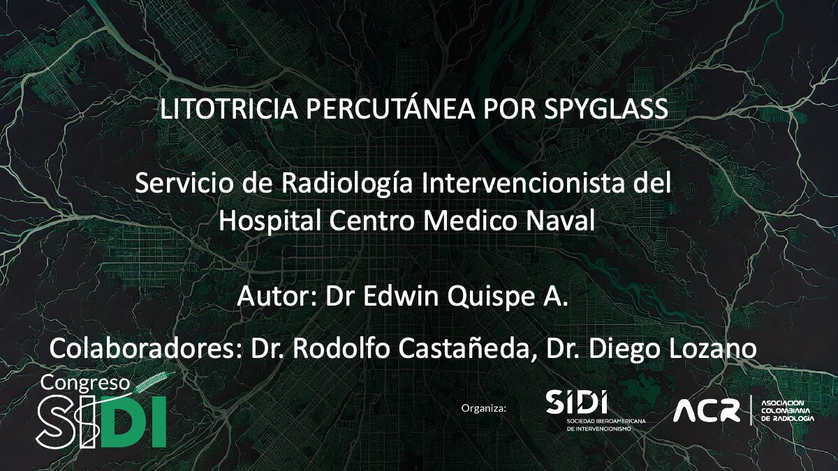 Litotricia percutánea por Spyglass