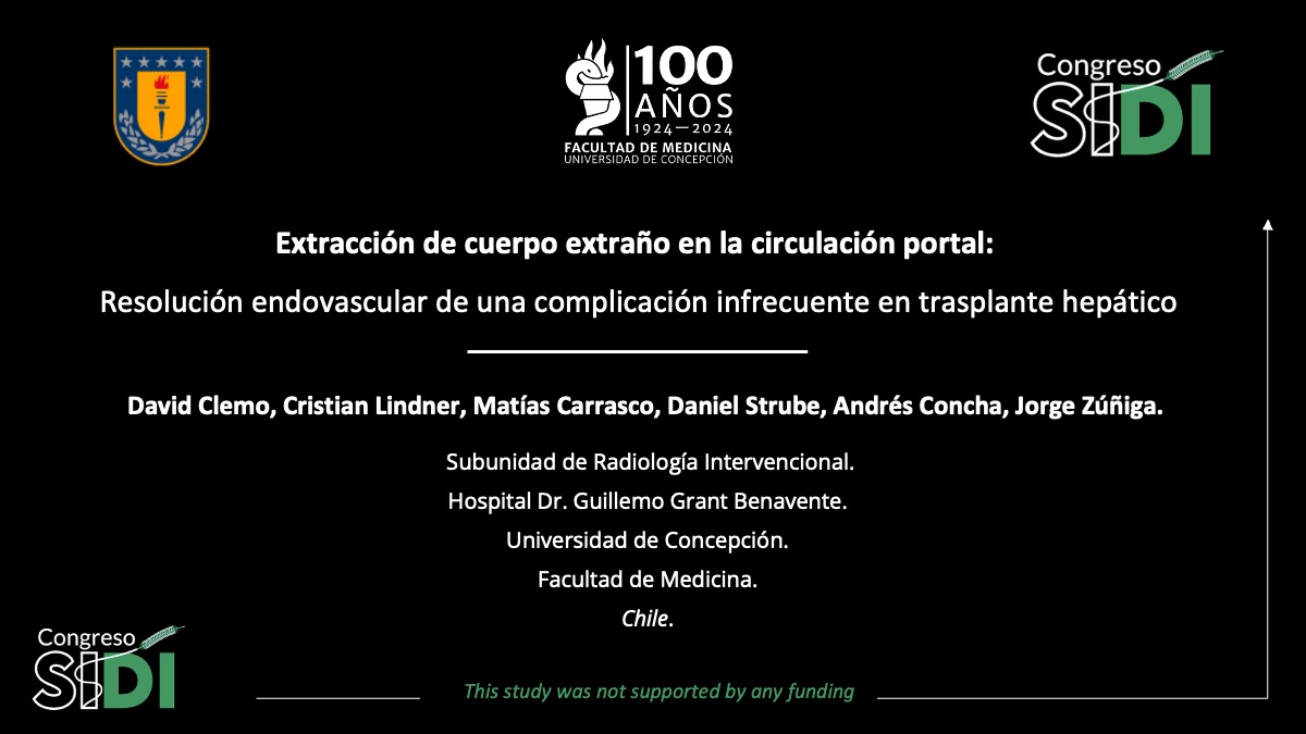 Extracción de cuerpo extraño en la circulación portal